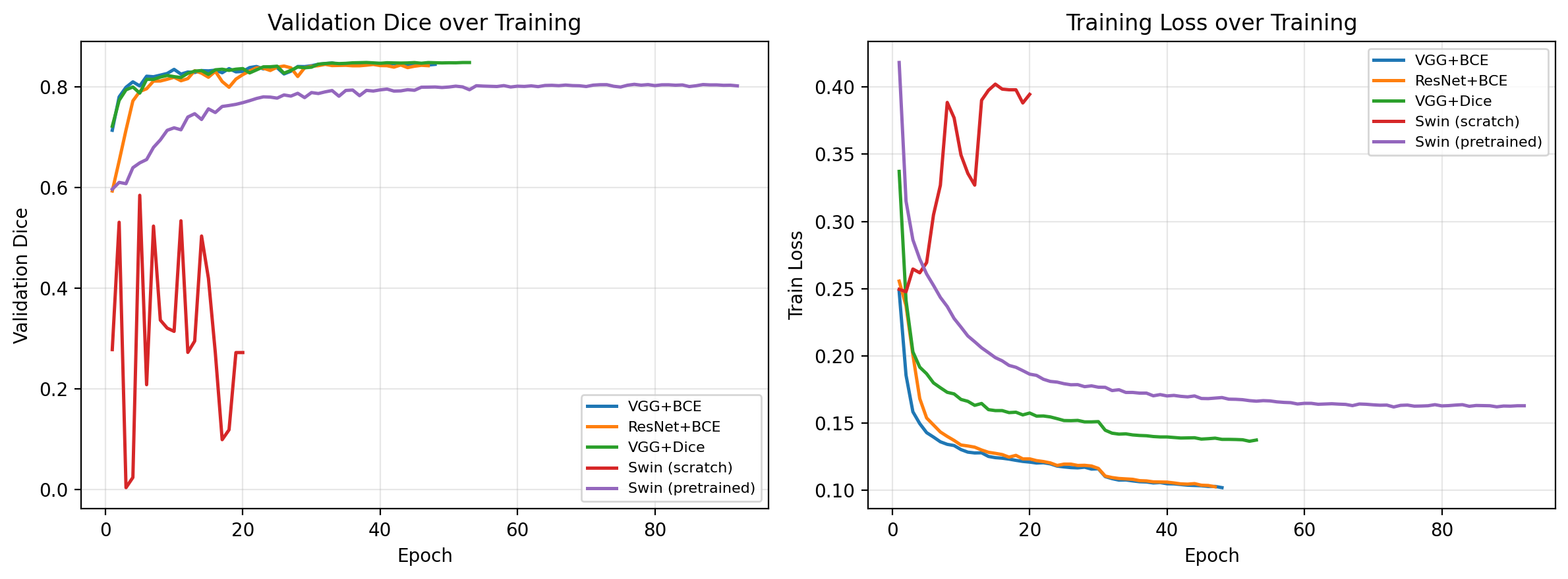 Training and validation Dice score curves across encoder architectures (VGG, ResNet, Swin-T) over training epochs on PanNuke and MoNuSeg.